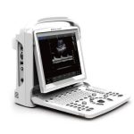 Chison ECO-3 Expert Portable Color Ultrasound