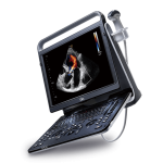 Chison EBit 60 Ultrasound