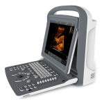 CHISON ECO-2 Color Digital Ultrasound Machine