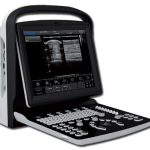 Chison ECO-1 Portable Ultrasound