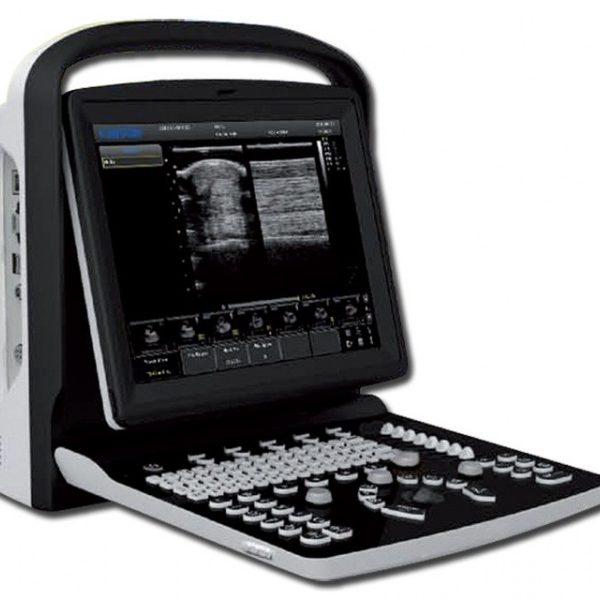Chison ECO-1 Portable Ultrasound